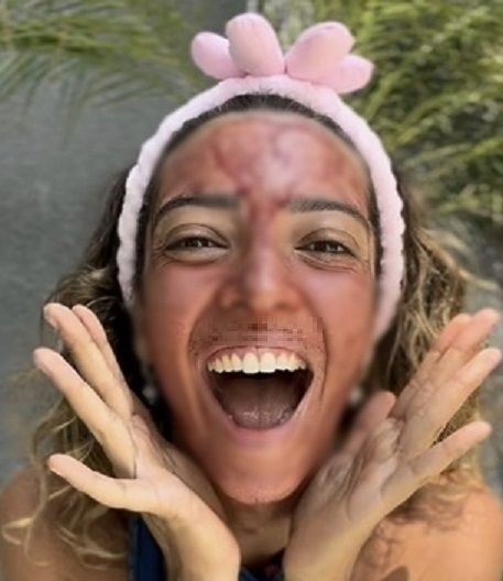 SNS서 유행하는 충격적 동안 비결, 얼굴에 바른다는 것이... 소름