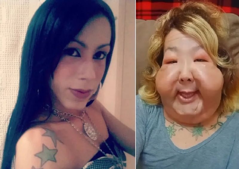 "평생 이 얼굴로 살아야 하나 두렵다"...갈색 머리 미녀의 충격 고백