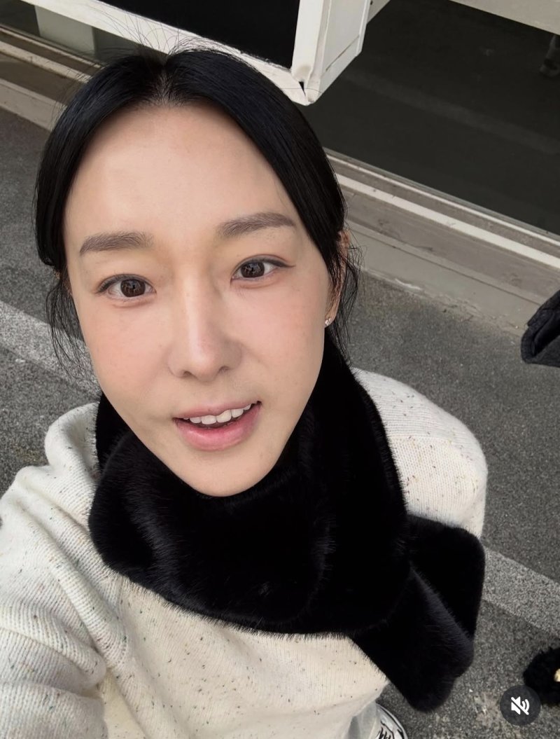 이지혜, 인중축소 수술 후 달라진 얼굴…더 예뻐져