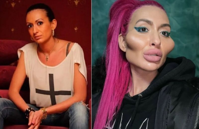 77만 인플루언서 모델, 10년 동안 미용 시술한 얼굴 상태가...?!