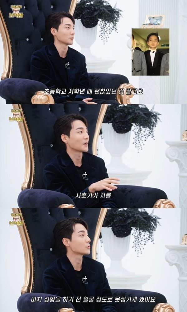 로이킴, '성형 전 사진' 해명…"사춘기가 못생기게 만들어"