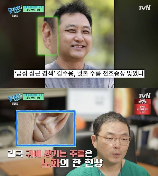 김수용 귓불주름, 심근경색 전조증상?…"노화 현상"