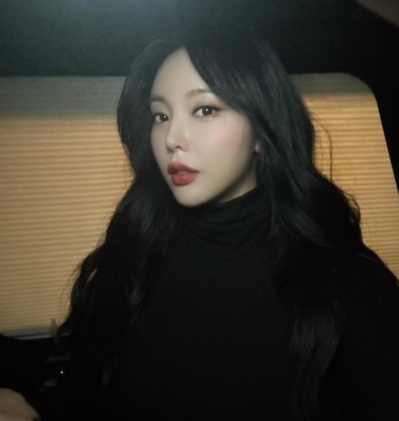 홍진영 깜짝 근황…어딘가 달라진 얼굴?