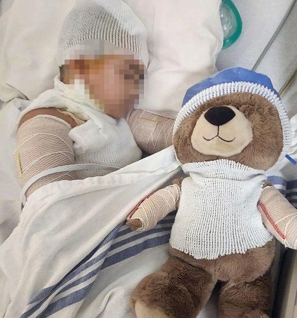 [뉴시스]8세 남자 아이가 휴대폰을 충전한 채로 잠에 들었다가 감전 사고를 당했다. (사진 = 피플 캡처) *재판매 및 DB 금지