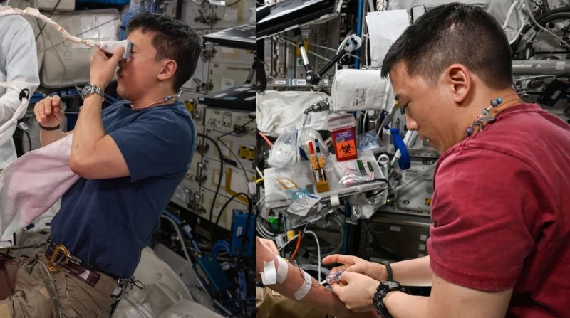 국제우주정거장(ISS) 승무원들의 혈액·안구 검사 등 건강 모니터링을 수행하는 조니 김.(NASA 제공)/뉴스1