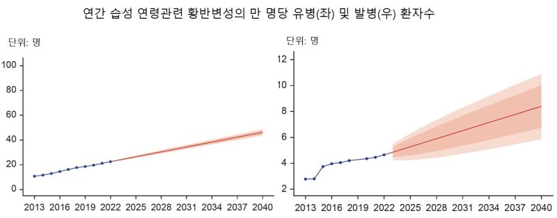 [서울=뉴시스] 연간 습성 연령관련 황반변성의 만 명당 유병(좌) 및 발병(우) 환자수. (사진= 분당서울대병원 제공)
