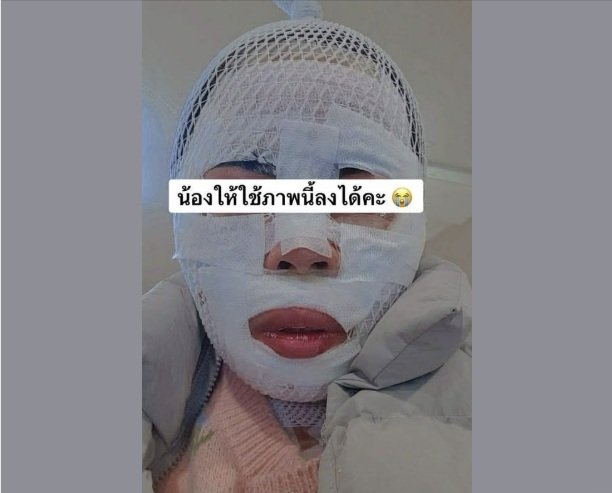 태국인 아내가 40대 한국인 남편의 끓는 물을 맞아 얼굴에 심각한 화상을 입었다. 경찰은 이 남성을 특수폭행 혐의로 입건해 조사 중이다./사진=연합뉴스