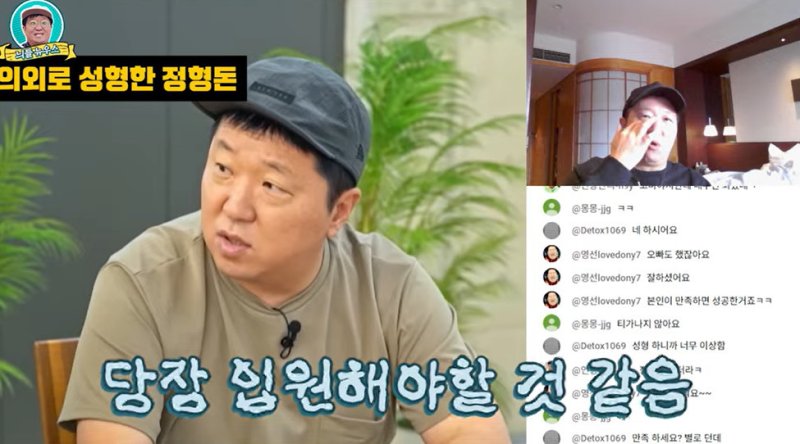 정형돈, 성형 후 충격적 부기 공개…"일주일 동안 못나가"