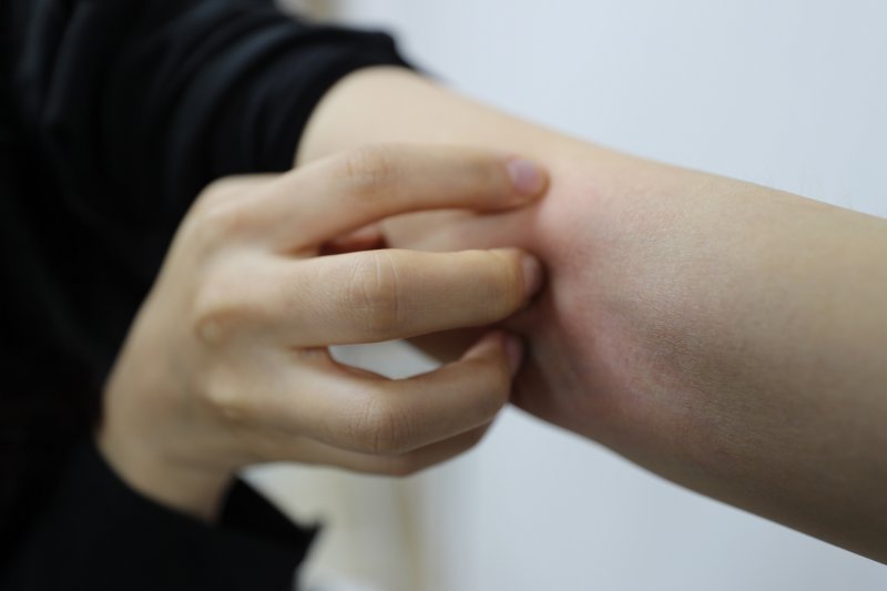 [서울=뉴시스]김대현 고려대학교 안암병원 피부과 교수. (사진= 고려대 안암병원 제공) 2025.03.18. photo@newsis.com.