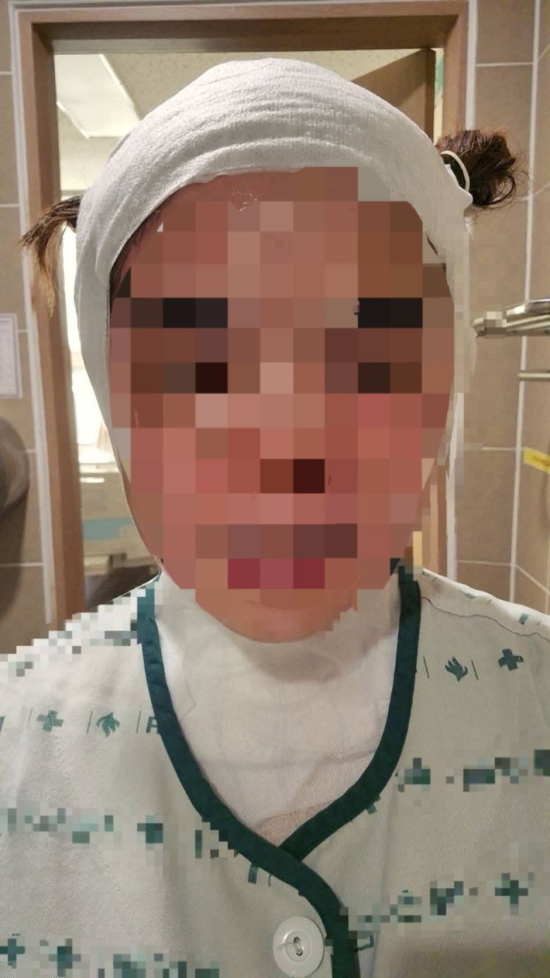 화상 입은 30대 태국인 여성(페이스북 갈무리. 재판매 및 DB 금지)/뉴스1