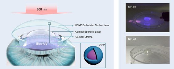 [포항=뉴시스] 송종욱 기자 = 포스텍 신소재공학과 한세광 교수 연구팀이 부산대 유기소재시스템공학과 김기수 교수, 연세대 의대 안과학교실 김태임 교수와 함께 각막 손상 없이 원추각막병증 및 근시 교정 치료법을 개발했다. 사진은 상향 변환 나노 입자가 담지된 콘택트렌즈 모식도와 근적외선 빛 조사 때 자외선 및 청색광을 발광하는 콘택트렌즈 모습. (사진=포스텍 제공) 2025.12.12. photo@newsis.com