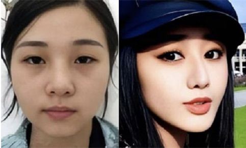 17억 들여 여배우랑 똑같이 성형한 30대女..조롱의 대상 된 뜻밖의 이유  