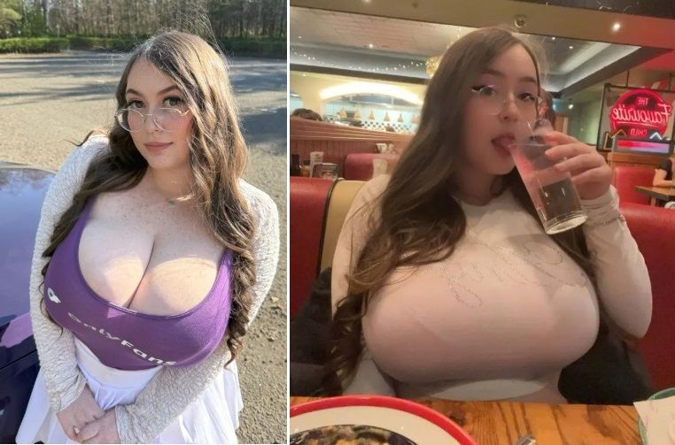 가슴이 계속 커진다 20대女, 한 달 수입이 무려..