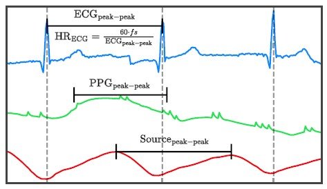 [서울=뉴시스] 심전도(파란색), 광용적맥파 원 신호(초록색), 인공지능으로 분리된 근원 신호(빨간색) 비교. 분리된 근원 신호에서는 심전도 기준 심장 박동 시점과 일치하는 피크가 뚜렷하게 나타난다. (사진= 서울대병원 제공)