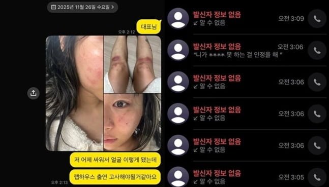 래퍼 재키와이가 지난달 15일 전 연인이자 힙합 프로듀서 방달로부터 데이트 폭력을 당했다고 주장했다. /사진=재키와이 인스타그램, 뉴시스
