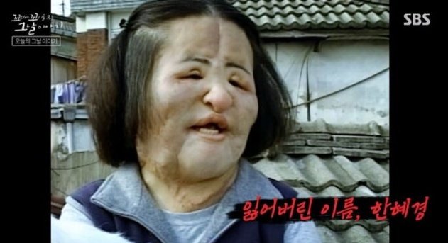 선풍기 아줌마, 불법성형 전 연예인급 미모 공개 "원래 가수였다"