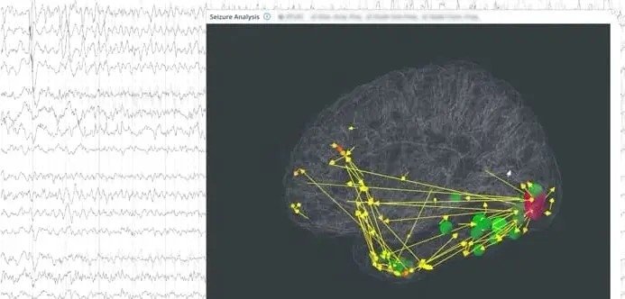 이진형 스탠퍼드 교수, AI 뇌진단 플랫폼 '뉴로매치'로 에디슨상 (출처=연합뉴스)
