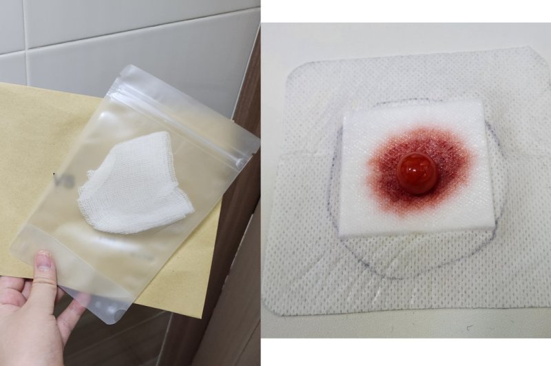 [서울=뉴시스] 이승주 기자 = 'A Life in a Day' 프로그램에서 실제 기자가 체험한 것. 왼쪽은 구토를 위한 냄새나는 거즈, 오른쪽은 종양을 표현하는 구슬과 밴드. 2026.02.01. heyjude@newsis.com *재판매 및 DB 금지