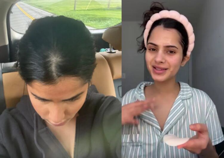 불안을 달래기 위해 시작한 음주가 3년간의 알코올 의존으로 이어지며 치아 손상, 탈모, 호르몬 이상, 간 기능 이상까지 겪은 대학생 사연이 전해졌다. 사진=알쿠자마 SNS