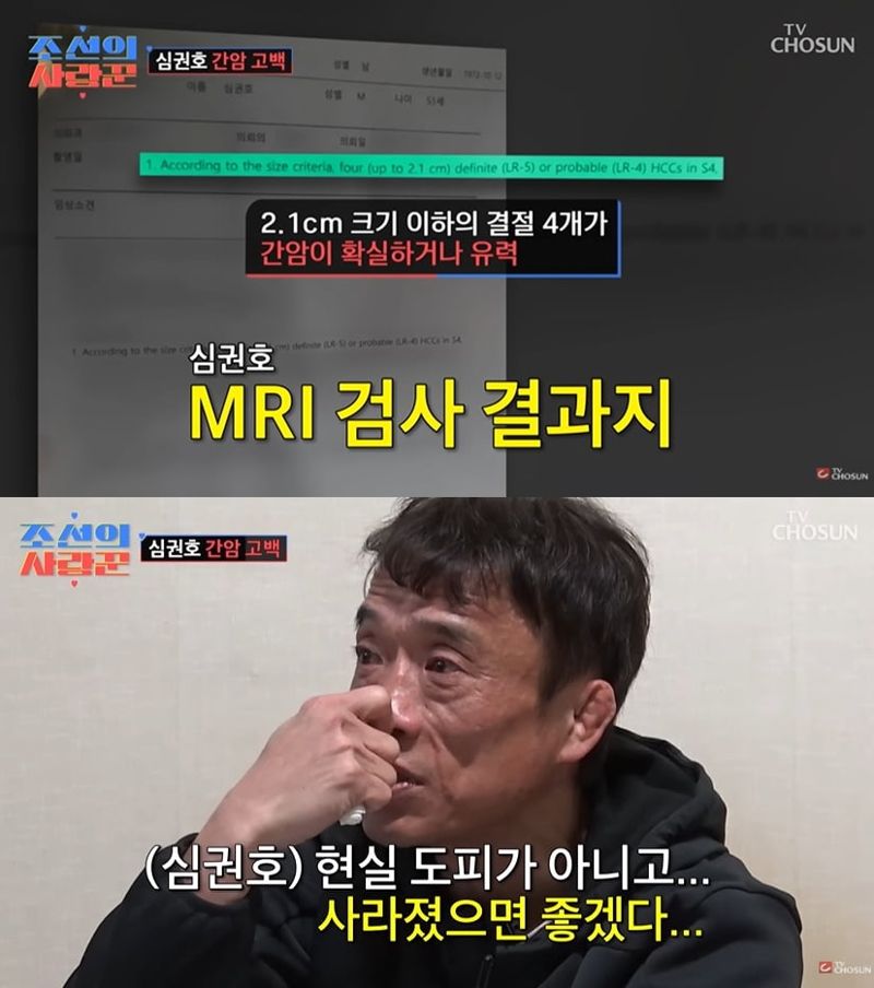 /사진=연합뉴스, 조선의 사랑꾼 캡처