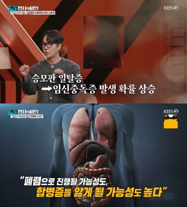 故서희원, 선천성 심장질환&middot;임신중독증…"폐렴 더 악화할 수 있다"