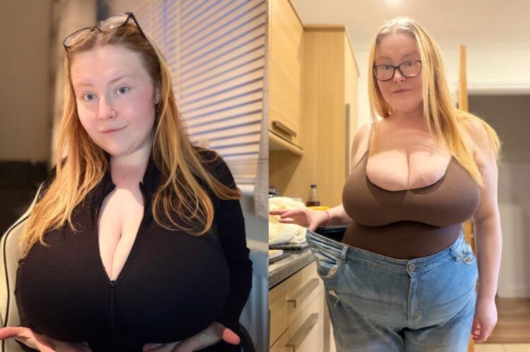 30대 女, 살 빠지는데 가슴만 '쑥쑥'...비만 치료제 복용 중 '희귀 질환' 발견  