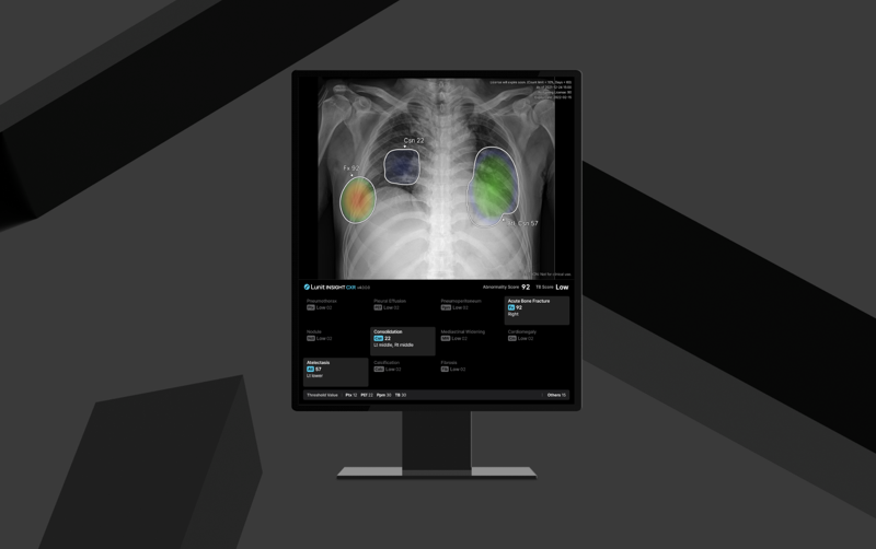루닛, AI 영상진단 솔루션 '외주 판독시장'까지 진출