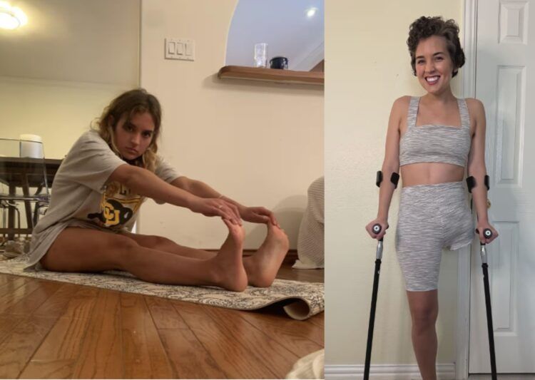 30세女, 골반 절단…무서운 '이 암' 이었다  