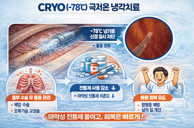 "극저온 냉각치료로 흉부수술 ‘마의 통증’ 관리"