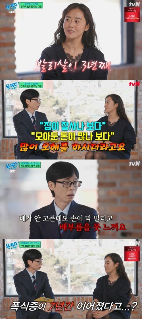 허가윤 "7년간 폭식증 이어져…정신과 상담까지" [RE:TV]