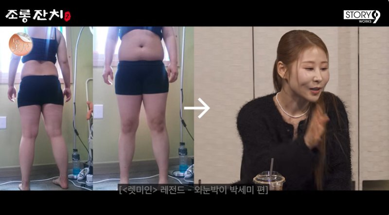 박세미, 성형수술&middot;20㎏ 다이어트 전 사진 공개…이용진 "인간승리"