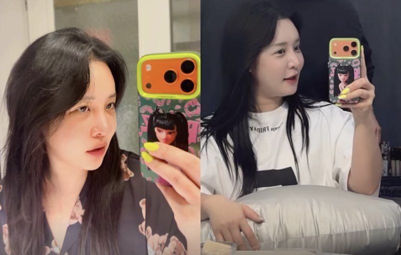 눈&middot;코 수술 고백하더니…랄랄 확 달라진 근황