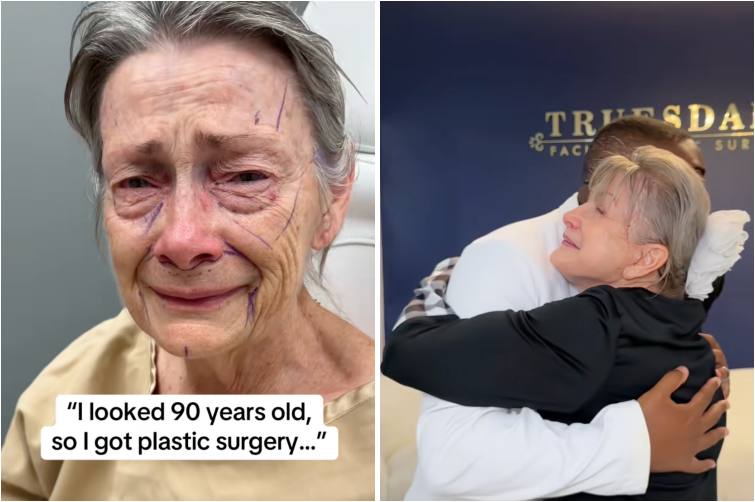 나이보다 늙어 보이는 70대 여성이 안면거상술을 받은 뒤 획기적으로 젊어진 모습을 공개한 뒤 온라인에서 화제가 됐다. 수술 전 자신이 '90세로 보여 수술을 결정했다'고 고백한 여성(왼쪽)은 한 달 뒤 달라진 모습에 의료진에게 감사의 인사를 전했다. /사진=틱톡 캡처