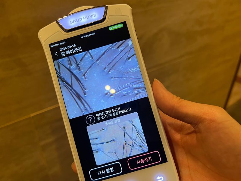 두피를 근접 촬영하는 전문 디바이스. 사진 속 모발의 굵기가 제각각으로 연모화(모발이 가늘어지는 현상)이 많이 진행된 것으로 보인다.