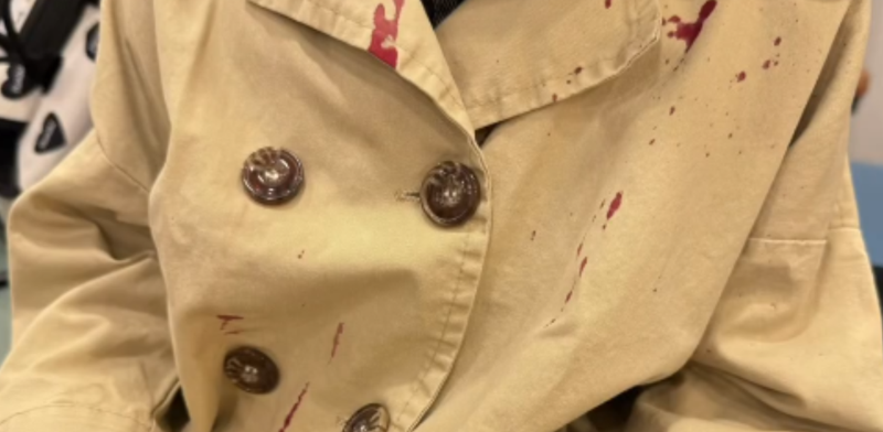 횡단보도를 건너던 5살 아이가 자전거를 탄 중학생과 충돌한 뒤 아이 옷에 피가 묻은 모습. /사진=엑스 갈무리