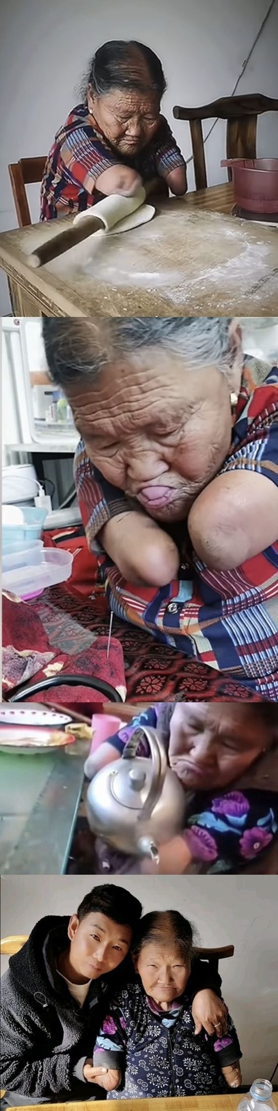 "삶이 참 고됐지만" 사지 없는 80대 노모의 위대한 모정