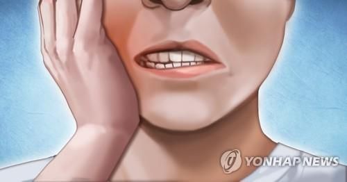 풍치가 무서운 이유는 초기에 거의 통증이 없다는 것으로, 아프다고 느낄 때는 이미 상당히 진행된 경우가 많다. /사진=연합뉴스
