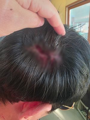 폭행으로 상처를 입은 A씨의 모습. A씨 제공