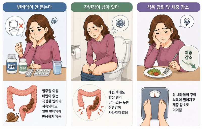 대장무력증의 특징적인 증상 3가지. /사진=챗GPT