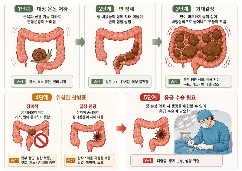 대장무력증의 진행 과정과 합병증. /사진=챗GPT
