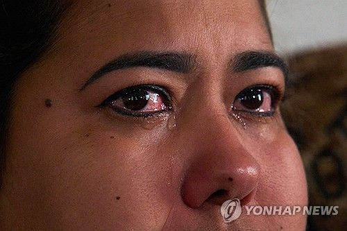 쿠바 여성이 인터뷰 도중 눈물을 흘리고 있다 (출처=연합뉴스)