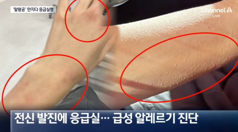 /사진=채널A
