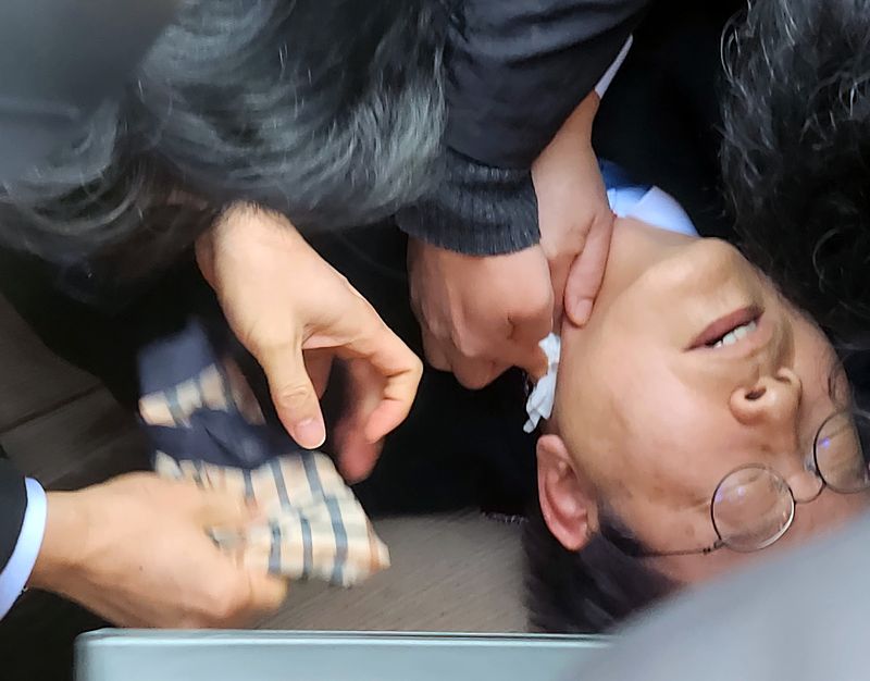 이재명 더불어민주당 대표가 2일 가덕도 신공항 부지 현장에서 괴한의 불상자로부터 피습당했다. 사진은 피습을 당한 이 대표 모습. 2024.1.2 ⓒ 뉴스1