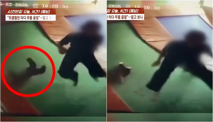 3살 아이가 어린이집 행사로 찾은 키즈카페에서 트램펄린을 타다 무릎 골절과 성장판 손상을 입는 사고를 당했다. /사진=사건반장 캡처