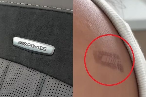 벤츠 로고의 화상 자국. 사진=SNS 캡처