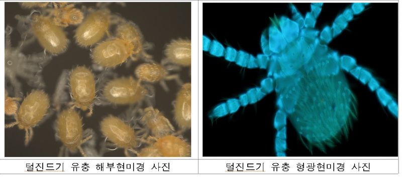 털진드기 유충 현미경 사진. 질병관리청 제공