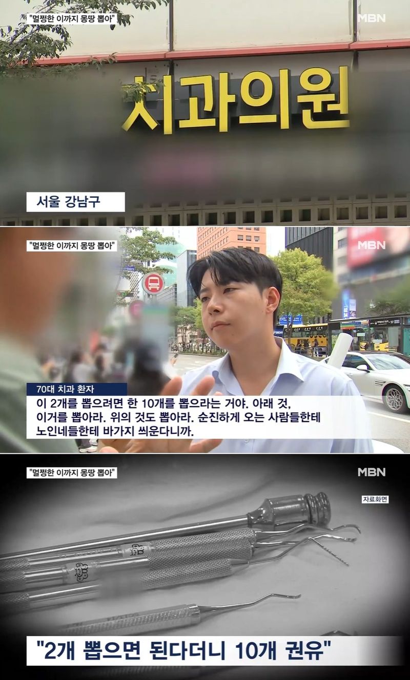 /사진=MBN 뉴스 캡처