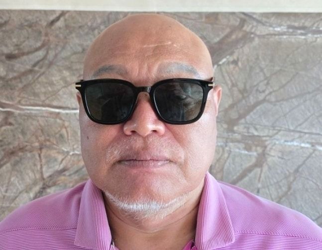 가수 김흥국이 탈모 치료제 홍보 모델로 발탁됐다. 김흥국 측 제공