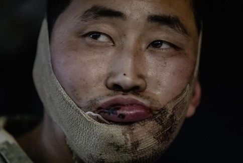 지난해 1월 우크라이나군이 러시아 쿠르스크에서 생포한 북한군. 볼로디미르 젤렌스키 우크라이나 대통령 텔레그램 캡처. 연합뉴스