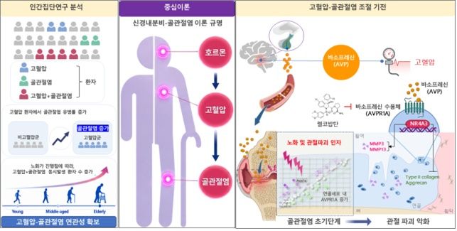 [서울=뉴시스]고혈압 환자에서 골관절염 유병률이 높게 나타났으며, 고혈압 생쥐 모델에서도 고혈압이 골관절염의 진행을 악화시키는 것으로 확인됐다. (사진=과기정통부 제공) *재판매 및 DB 금지